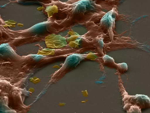 Razina dokaza: istraživački stadij s jasnim granicama