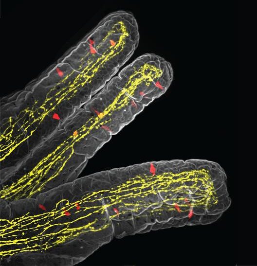 How Parasites Rewire Gut-Brain Signals to Curb Appetite